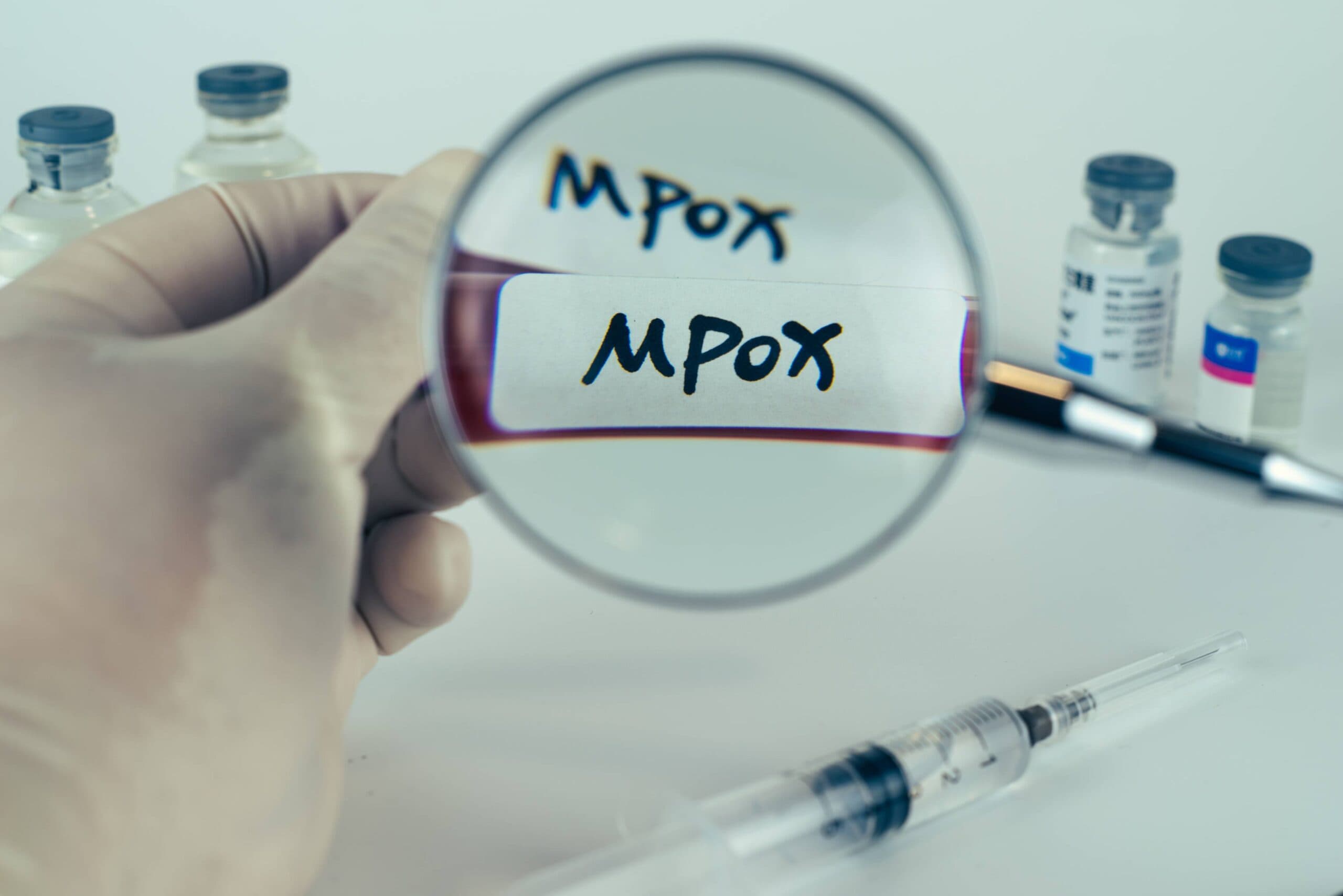 Mpox/Đậu mùa khỉ là gì? Một nhà vi sinh vật học giải thích những gì được biết về họ hàng đậu mùa này
